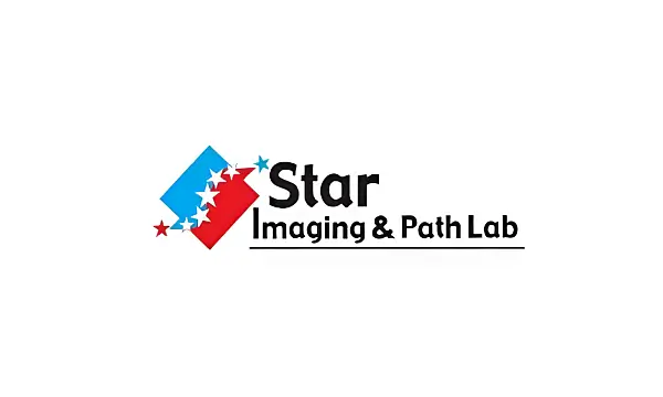 Star Imaging IPO GMP